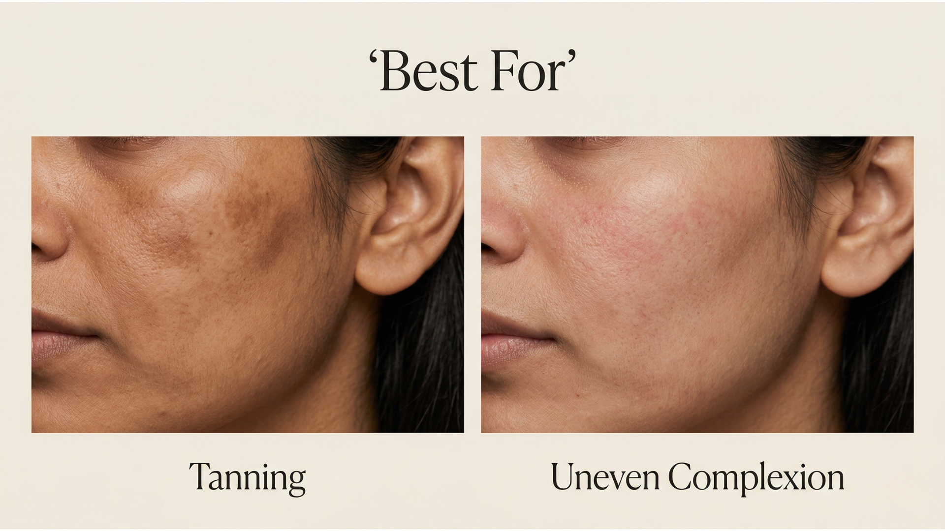 Best Night Cream for Uneven Skin